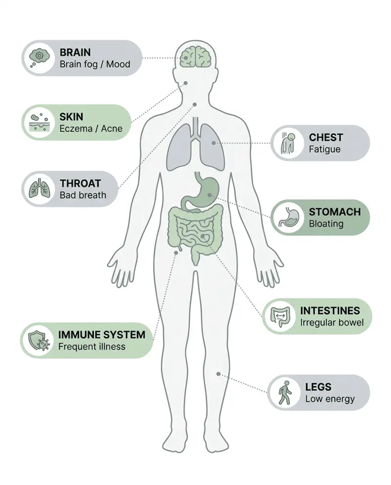 Body symptom map showing how gut imbalance affects brain, skin, stomach, immune system and more